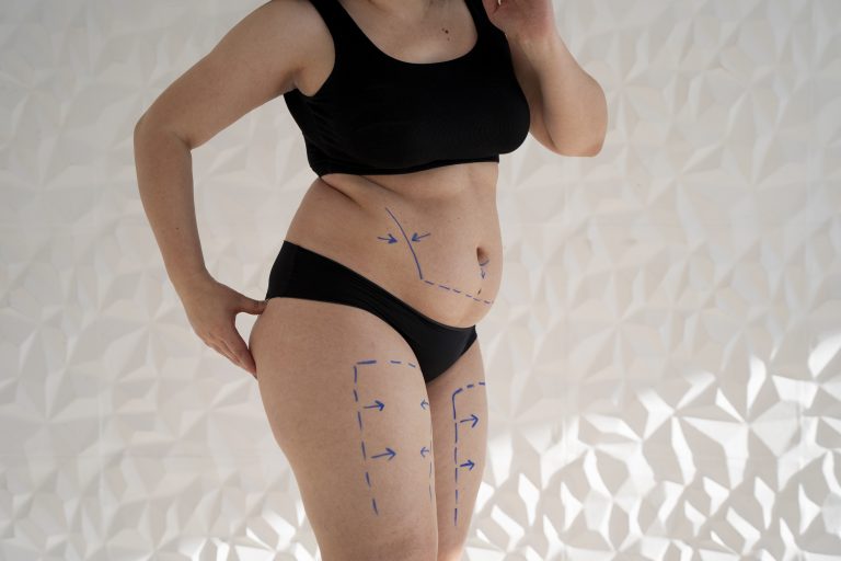 Drainage lymphatique post‑opératoire corps